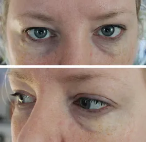 Jess FX - Old Age Eye Bags Character Prosthetics (Encapsulated Silicone)